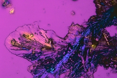 Crystals of cisplatin, a platinum compound that is used as a chemotherapy drug, are shown here