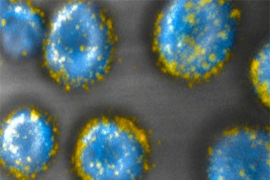MIT engineers have developed a way to attach drug-carrying pouches (yellow) to the surfaces of cells.