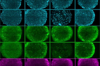 This image shows rows of human embryonic stem cells that MIT researchers grew on a new synthetic surface. The cells at top (blue) are stained to reveal their nuclei, while the cells in the middle and bottom are stained for proteins that are known to be present when cells are pluripotent.