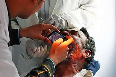 Using Sana, health-care workers take photos of precancerous lesions inside a patient’s mouth in India. Those images were then transmitted to an oncologist for diagnosis.