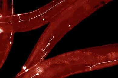 MIT engineers have developed a way to rapidly perform surgery on single nerve cells in the worm C. elegans. The white lines represent axons — long extensions of nerve cells that carry messages to other cells.