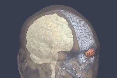 This image shows the detailed anatomical features of the brain that Radovitzky and his colleagues analyze using models that simulate explosive blasts.