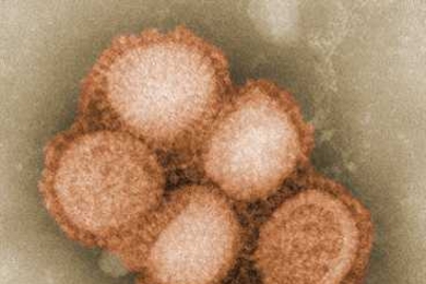 An image of the H1N1 influenza virus taken in the CDC Influenza Laboratory.