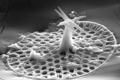 An image of the microfossil Characodictyon taken with a scanning electron microscope. This fossil was extracted using very weak acid from a carbonate rock. It's about 20 microns long - one-fifth the width of a human hair.