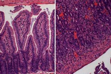 The image at left shows tissue from the small intestine of a mouse infected with type II parasites that transgenically expresses the type I ROP16. At right, in a mouse infected with Toxoplasma gondii, the intestines are inflamed and have lost much of their normal structure.
