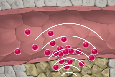 MIT researchers designed nanoparticles that can quickly locate a tumor, then set off a chemical reaction that attracts larger swarms of drug-delivering nanoparticles to the site.