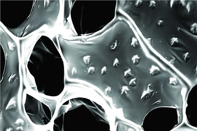 A scanning electron microscope (SEM) image of nanowire-alginate composite scaffolds. Star-shaped clusters of nanowires can be seen in these images.