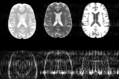 Two by three grid of brain scans