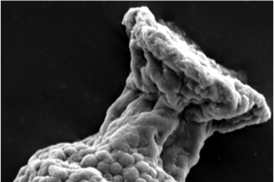 MIT researchers have found hundreds of tiny fossils of the first known ciliates. The ciliates, named tintinnids, resided in hard, flask-shaped shells with bubbled exteriors that likely help them float.