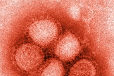 An influenza strain.