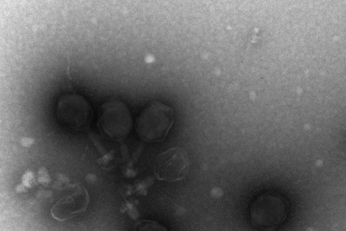 A transmission electron micrographs of prochlorococcus virus.