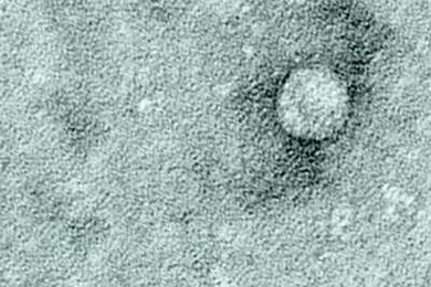 An image of hepatitis C