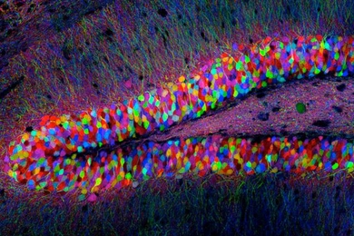 An image of a transgenic mouse hippocampus.