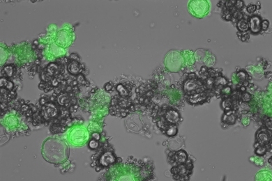MIT researchers designed these particles that can produce proteins when ultraviolet light is shone on them. In this case, the protein is green fluorescent protein.