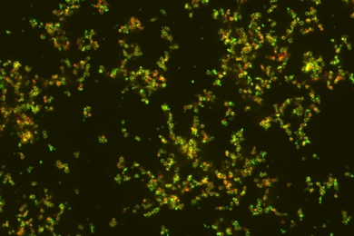 Nanoparticles, in green, targeting bacteria, shown in red.