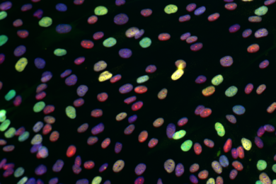Differential cell responses to chemotherapy treatment. The photo shows a range of responses of similar cells to the chemotherapeutic drug doxorubicin. The most intensely responding drugs are shown in yellow, many of which will die. Green cells are alive but not dividing. Red cells are continuing to grow and divide. Yaffe and colleagues have figured out how to increase the proprotion of triple nega...