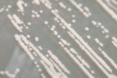 Yeast colonies shown close up.