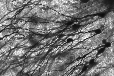 An image of Golgi stained neurons in the dentate gyrus of an epilepsy patient.