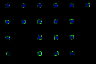 'MIT is equal to infinite' pattern was made of various spatially organized cell types in defined geometries. 'MIT' and 'equal' patterns were made of spatially distributed human hepatoblastoma cells and NIH-3T3 fibroblasts. The infinite pattern was combination of one circular and one square pattern which were made of spatially arranged human hepatoblastoma cells and human umbilical vein endothelial...