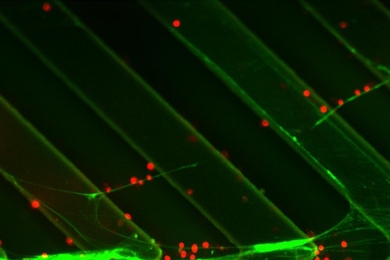 Cells traveling through a microfluidic device can be trapped by strands of DNA (green).