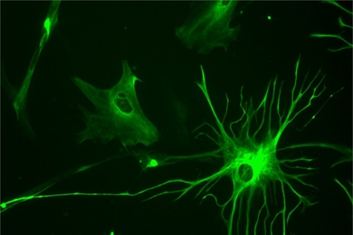Neuroscientists have found that glial cells, which make up about half the cells in the brain, may play more than just a supporting role.