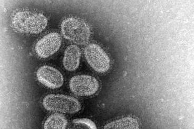 Electron microscopy of influenza virus