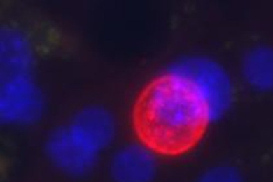 <i>Plasmodium vivax</i> (red sphere) grows in engineered liver tissue developed by MIT researchers to study malaria. The blue spheres represent the nuclei of cells that make up the microscale liver tissue.