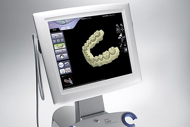 Lava Chairside Oral Scanner 
