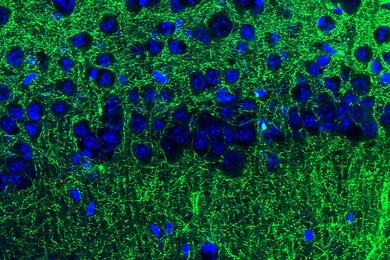 The tips of long neuronal extensions from the amygdala (green) contact neurons of the hippocampus (blue). This communication pathway helps to modulate anxiety.