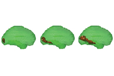 MIT researchers combined fMRI and MEG data to reveal which parts of the brain are active shortly after an image is seen. At around 60 milliseconds, only early visual cortex in the back of the brain was active (image at left). Then, activity spread to brain regions involved in later visual processing until the inferior temporal cortex was activated (image at right). This brain region represents com...