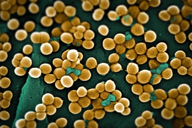 A scanning electron micrograph depicts numerous clumps of methicillin-resistant Staphylococcus aureus bacteria, commonly referred to by the acronym MRSA.
