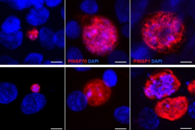 MIT researchers engineered liver-like cells that can be infected with several strains of the parasite that causes malaria, including Plasmodium falciparum (top row) and Plasmodium berghei (bottom row). The red stain reveals parasite infection.