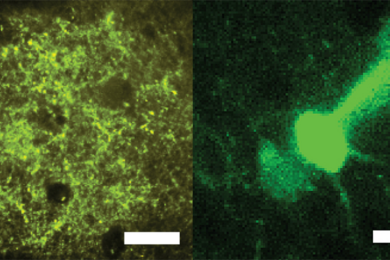 Two side-by-side micrographs of neurons