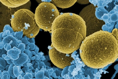 S. aureus bacteria and human white blood cells.