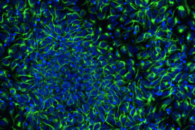 Human neuron progenitors express neural stem cell marker Nestin (green).