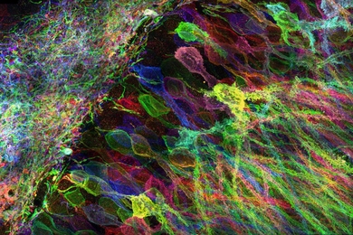 MIT researchers have developed a new way to image proteins and RNA inside neurons of intact brain tissue. 