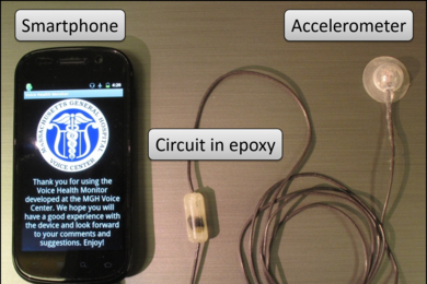 Accelerometers around patients' necks capture data about the motions of their vocal folds to determine if their vocal behavior was normal or abnormal.