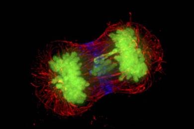A deconvolved wide-field fluorescence microscope image of human HeLa cancer cells, during late anaphase/early telophase, showing a lagging chromosome. If this fails to get into a daughter cell, it may lead to aneuploidy.