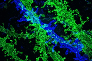 By expanding brain tissue twice, researchers were able to obtain high-resolution images of neurons in the hippocampus.
