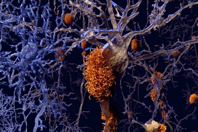 “Even though there has been a lot of high-resolution, atomic level structural work on amyloids by solid-state NMR, people have really not studied the metal-binding aspects,” says professor Mei Hong.
