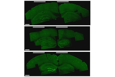 A brain slice that shows the hippocampus cells that were activated by the new stimulation technique (bottom image, lighter green areas on the left)