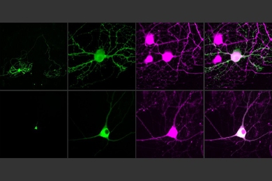 MIT researchers have devised a way to control single neurons using optogenetics. To help achieve this, they developed an opsin, or light-sensitive protein, that can be targeted to neuron cell bodies (bottom row). Neurons in the top row have traditional opsins that are distributed throughout their axons.


