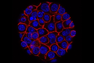 This image shows pancreatic cancer cells (nuclei in blue) growing as a sphere encased in membranes (red). 