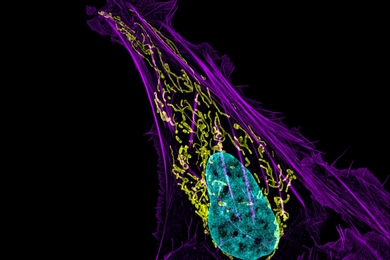This osteosarcoma cell appears with DNA in blue, mitochondria in yellow, and actin filaments in purple.