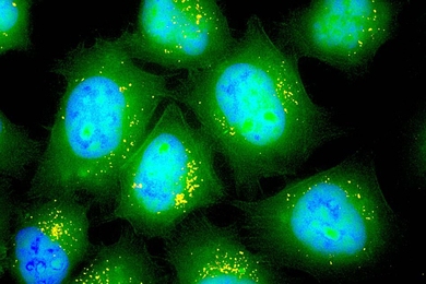 MIT researchers have designed inhalable particles that can deliver messenger RNA. These lung epithelial cells have taken up particles (yellow) that carry mRNA encoding green fluorescent protein.