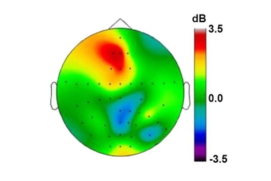 Researchers saw sharp increases in the power of theta frequency rhythms (warmer colors) in the frontal cortex as volunteers performed an experimental task.