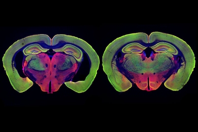 At left is the brain of a mouse genetically programmed to develop Alzheimer’s disease. At right, the brain of a mouse programmed to develop the disease, but treated with noninvasive visual stimulation, shows much less neurodegeneration.