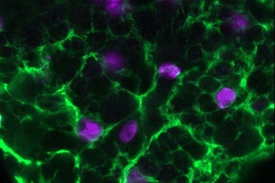 A new MIT Picower Institute study in a fruit fly model of epilepsy reveals how the genetic mutation involved leads to seizures: an imbalance of ions. 
