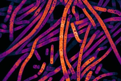 Fluorescent micrograph of the cyanobacteria Scytonema hofmanni