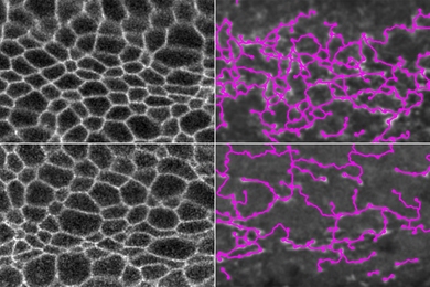 At top left are the cell membranes of a normal fruit fly embryo, and at right, overlaid in pink, is the myosin network that connects the cells. At bottom left are the cell membranes of an embryo in which myosin is degraded, and at bottom right, the myosin network is outlined in pink. In both cases, the embryos can still fold normally.